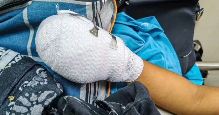 Điện thoại phát nổ