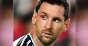 Vì sao Messi chảy máu cạnh mắt trong trận Argentina thắng Thụy Sĩ? Tình huống gây chú ý ở tứ kết World Cup 2026.