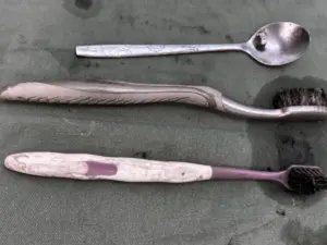 Bác sĩ phẫu thuật lấy 2 bàn chải và một thìa inox khỏi dạ dày nam bệnh nhân, cảnh báo nguy cơ nuốt dị vật ở người mắc hội chứng Pica.