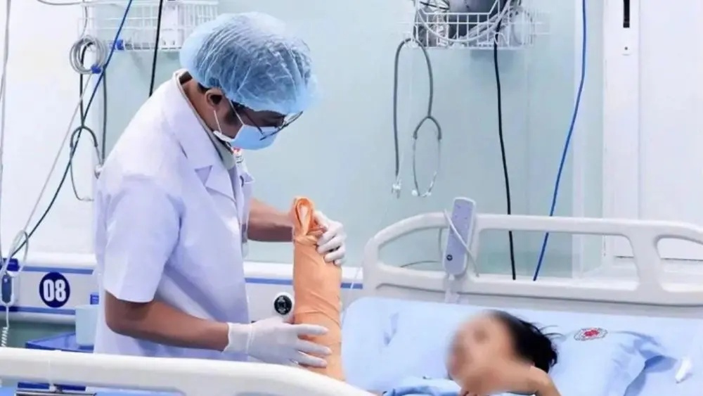 Bệnh viện Ngoại khoa 115 Nghệ An cứu cẳng tay gần đứt lìa cho phụ nữ 44 tuổi sau 4 giờ phẫu thuật căng thẳng.
