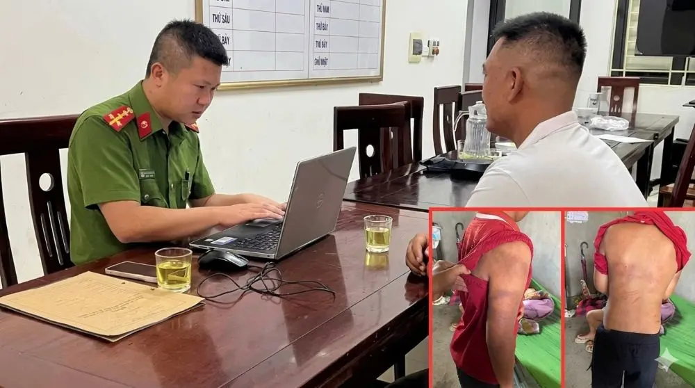 Vụ bé trai 10 tuổi bị bạo hành ở Nghệ An: Người cha sắp hầu tòa. Cập nhật diễn biến vụ việc và thông tin liên quan đến quá trình xử lý.